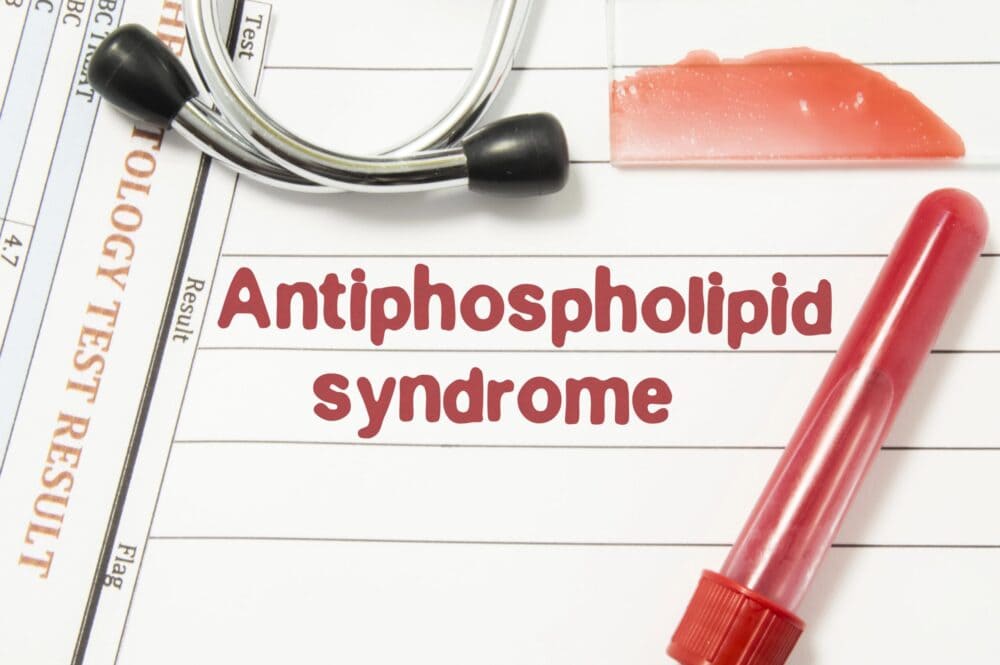 Welche Ernaehrung beim Antiphospholipid-Syndrom